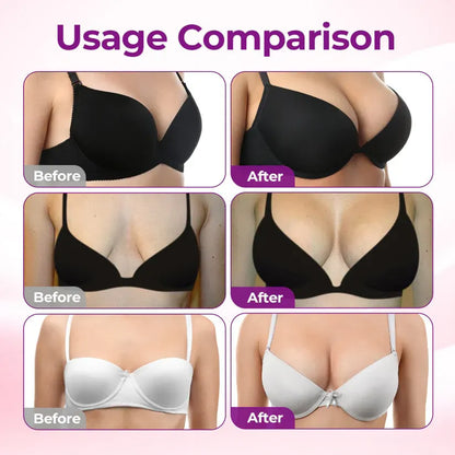 💥ÉCLANCIER® 💥Targeted Breast Enhancement Advanced Nano Microneedle Patch💥💥💥