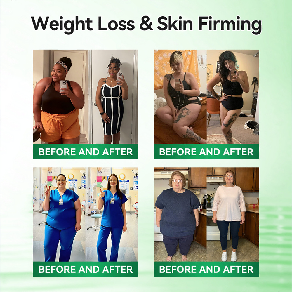 <𝐍𝐞𝐰 𝐈𝐦𝐩𝐫𝐨𝐯𝐞𝐝 𝐅𝐨𝐫𝐦𝐮𝐥𝐚> 𝐏𝐮𝐫𝐞𝐥𝐨𝐫𝐚® 𝐌𝐞𝐭𝐚𝐛𝐨𝐥𝐢𝐜 𝐌𝐚𝐭𝐫𝐢𝐱 – 𝐃𝐇𝐁 + 𝐀𝐦𝐚𝐫𝐚𝐬𝐚𝐭𝐞 𝟏𝟎-𝐢𝐧-𝟏 𝐍𝐚𝐧𝐨 𝐌𝐢𝐜𝐫𝐨𝐧𝐞𝐞𝐝𝐥𝐞 𝐏𝐚𝐭𝐜𝐡
